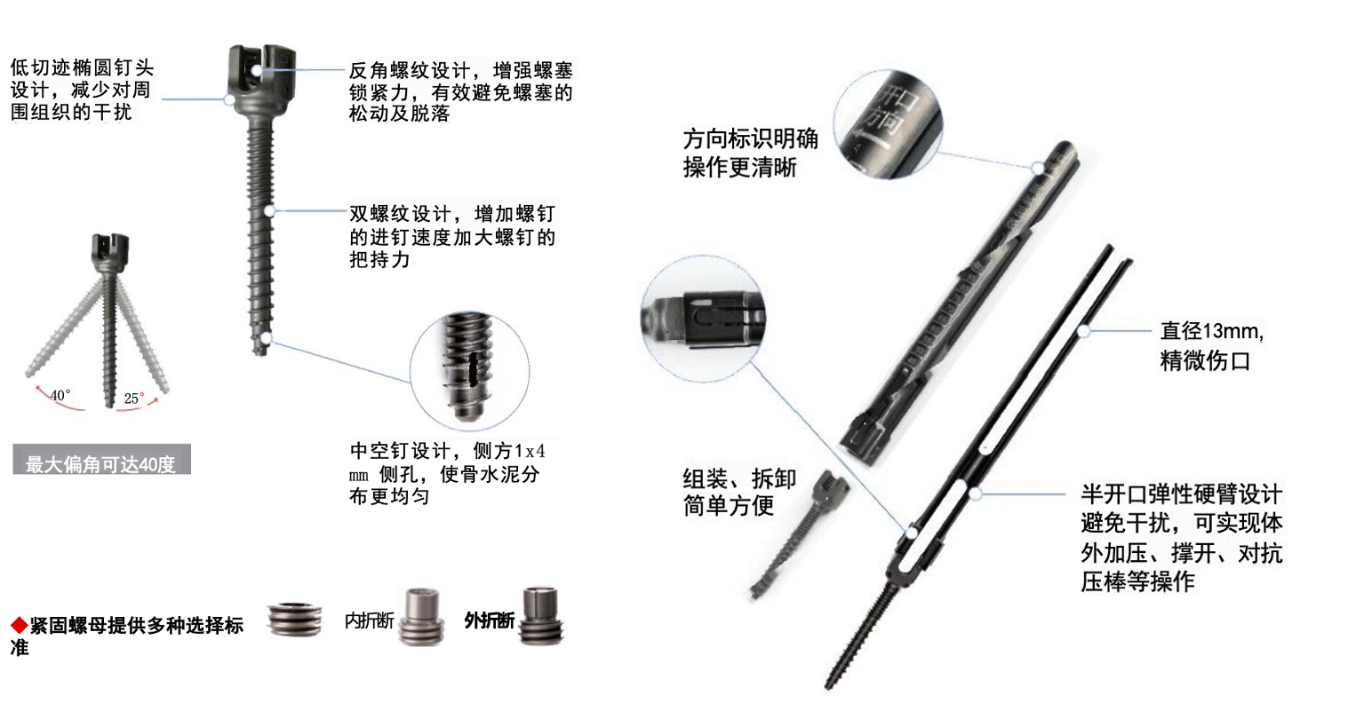 GSS胸腰椎后路内固定系统